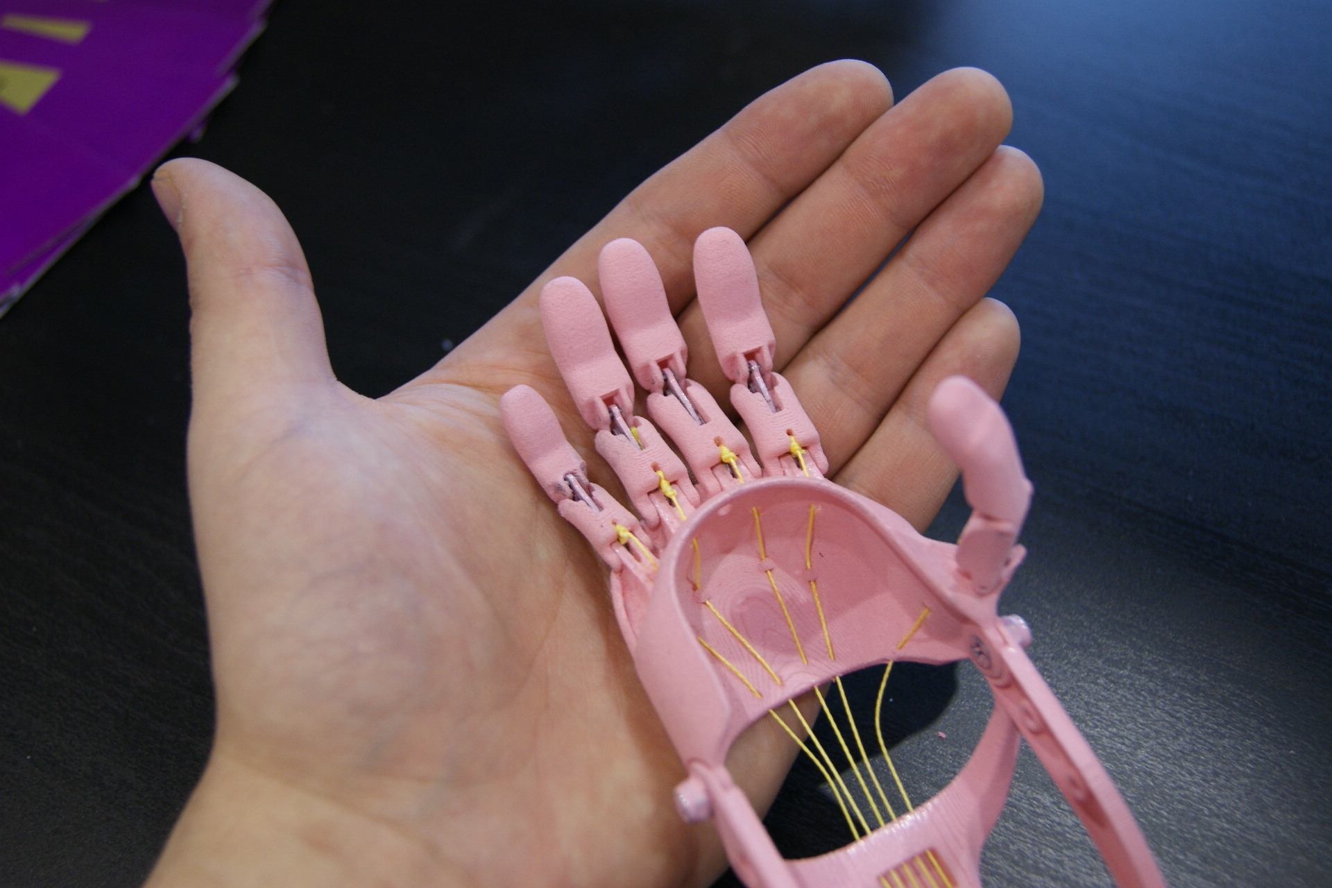 В России сделан первый 3D-протез